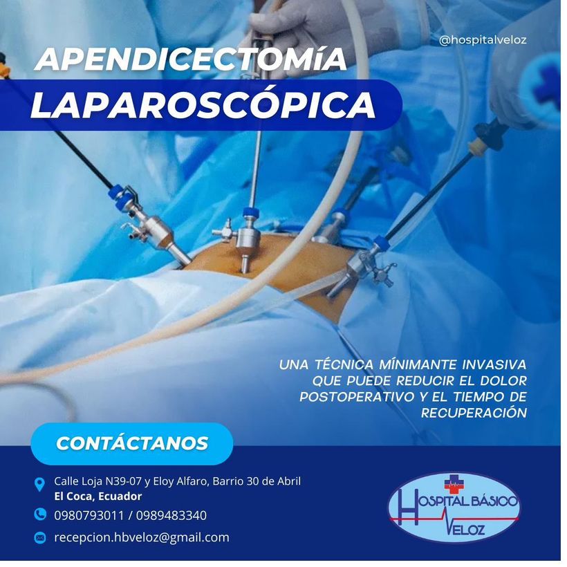 Apendicectomía laparoscópica