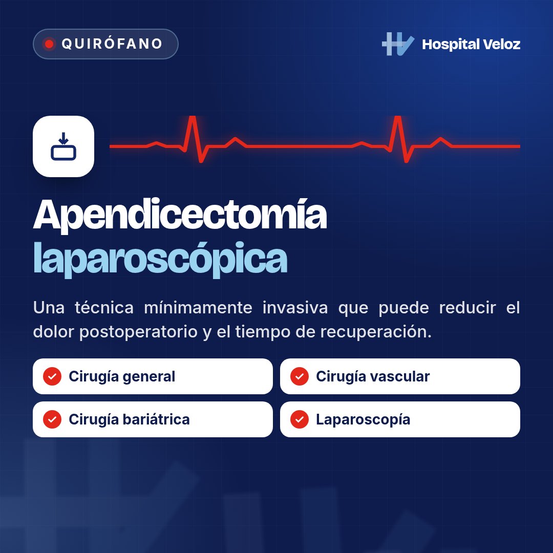 Apendicectomía laparoscópica